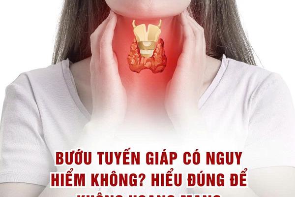 Bướu tuyến giáp có nguy hiểm không?