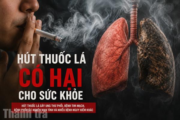 Cai nghiện thuốc lá: Nhu cầu lớn nhưng dịch vụ hỗ trợ còn hạn chế
