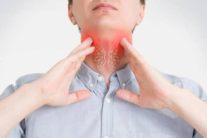 Bướu cổ lành tính có thể tăng kích thước không?