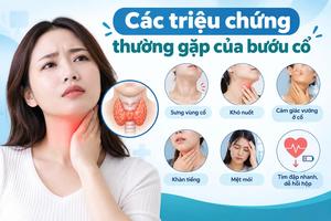 Các triệu chứng thường gặp của bướu cổ
